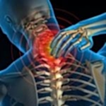 Boyun Fıtığı ve Pilates