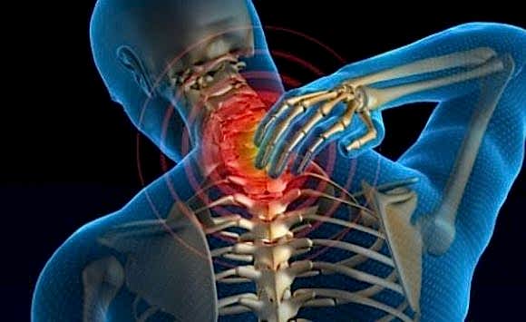 Boyun Fıtığı ve Pilates